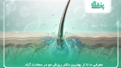 معرفی 10 تا از بهترین دکتر ریزش مو در سعادت آباد【سال 1405】❤️