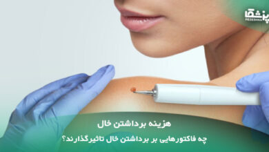 هزینه برداشتن خال؛ چه فاکتورهایی تاثیرگذارند؟