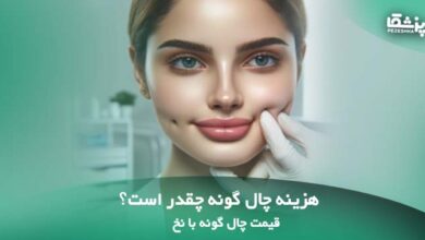 هزینه چال گونه چقدر است؟