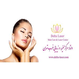مرکز لیزر دلتا