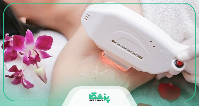 اقدامات مراقبتی قبل از لیزر