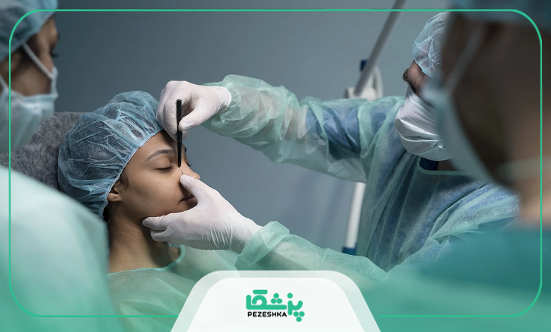 اقدامات قبل از جراحی بینی