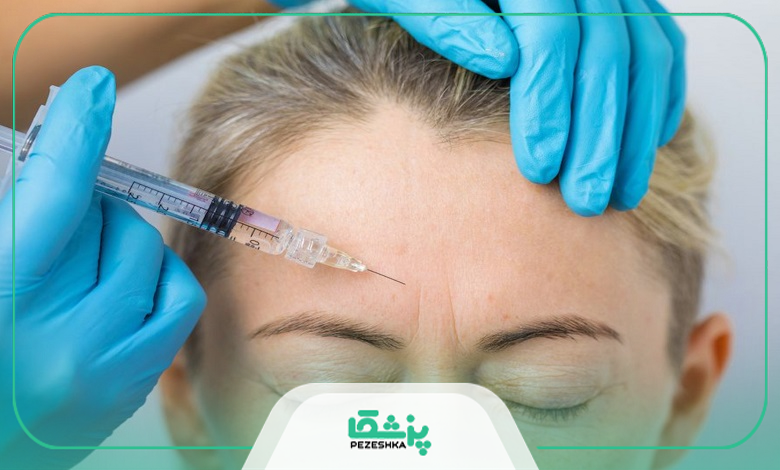 کاربردهای تزریق بوتاکس