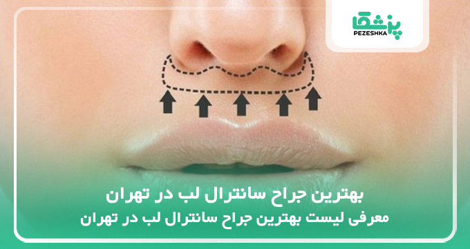 بهترین جراح سانترال لب در تهران