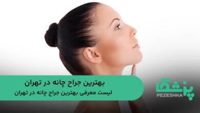 بهترین جراح چانه در تهران