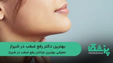 بهترین دکتر رفع غبغب در شیراز