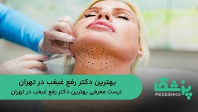 بهترین دکتر رفع غبغب در تهران