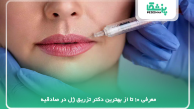 بهترین دکتر تزریق ژل در صادقیه
