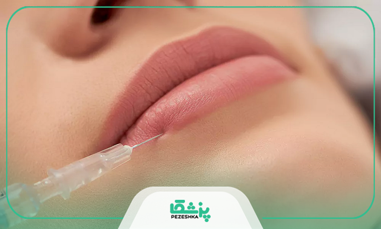 کاربردهای تزریق ژل