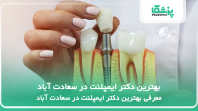 بهترین دکتر ایمپلنت در سعادت آباد