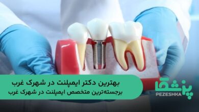 بهترین دکتر ایمپلنت در شهرک غرب
