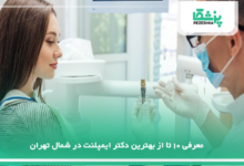 بهترین دکتر ایمپلنت در شمال تهران