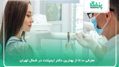 بهترین دکتر ایمپلنت در شمال تهران