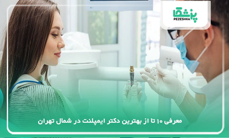 بهترین دکتر ایمپلنت در شمال تهران