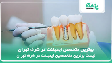 بهترین متخصص ایمپلنت در شرق تهران
