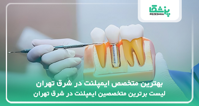 بهترین متخصص ایمپلنت در شرق تهران
