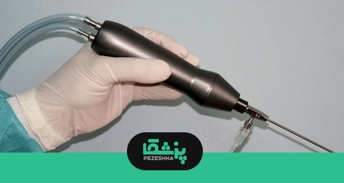 مزایای عمل لیپوماتیک
