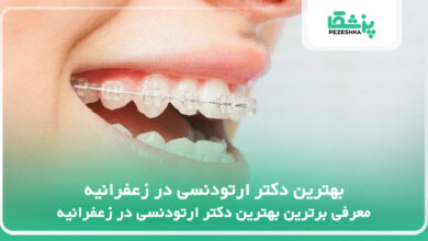 بهترین دکتر ارتودنسی در زعفرانیه