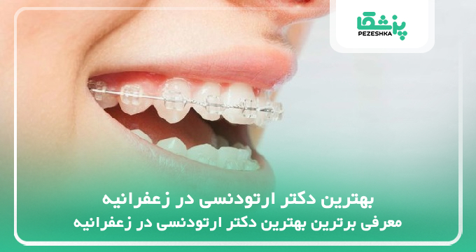 بهترین دکتر ارتودنسی در زعفرانیه