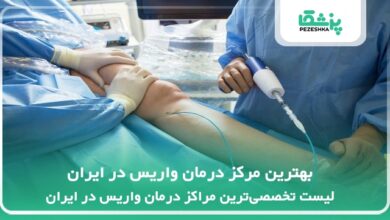 بهترین مرکز درمان واریس در ایران