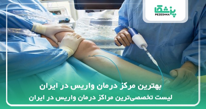 بهترین مرکز درمان واریس در ایران