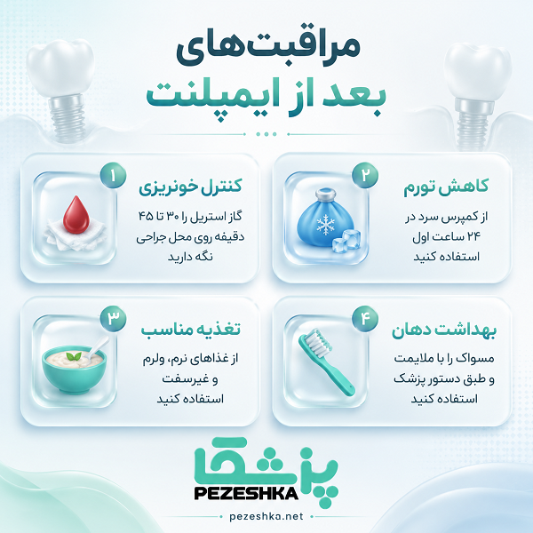 روش های شناخت بهترین دکتر ایمپلنت در زعفرانیه