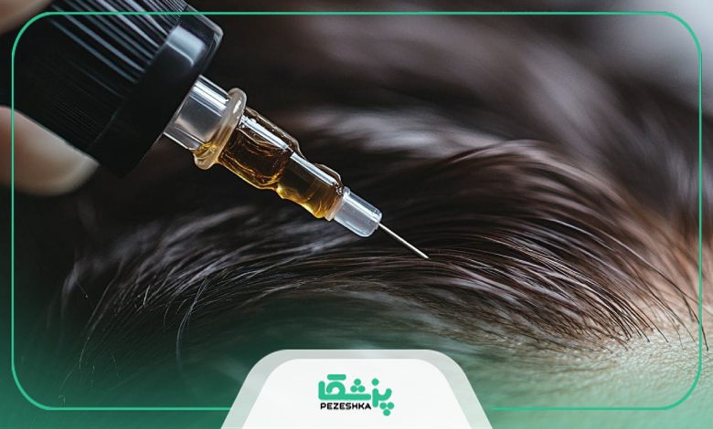 مزوتراپی مو چه عوارضی در بر دارد؟