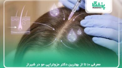 معرفی 10 تا از بهترین دکتر مزوتراپی مو در شیراز【سال1405】❤️
