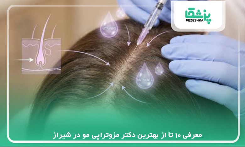 معرفی 10 تا از بهترین دکتر مزوتراپی مو در شیراز【سال1405】❤️