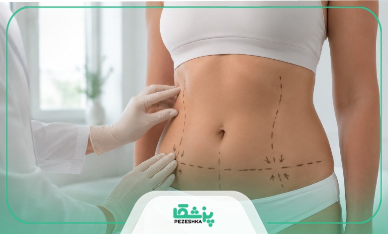 توصیه های مراقبتی بهترین جراح ابدومینوپلاستی در جردن