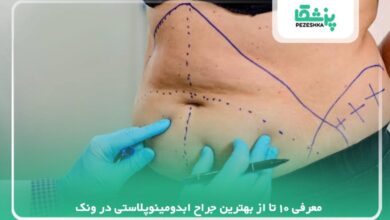 معرفی 10 تا از بهترین جراح ابدومینوپلاستی در ونک【سال1405】❤️