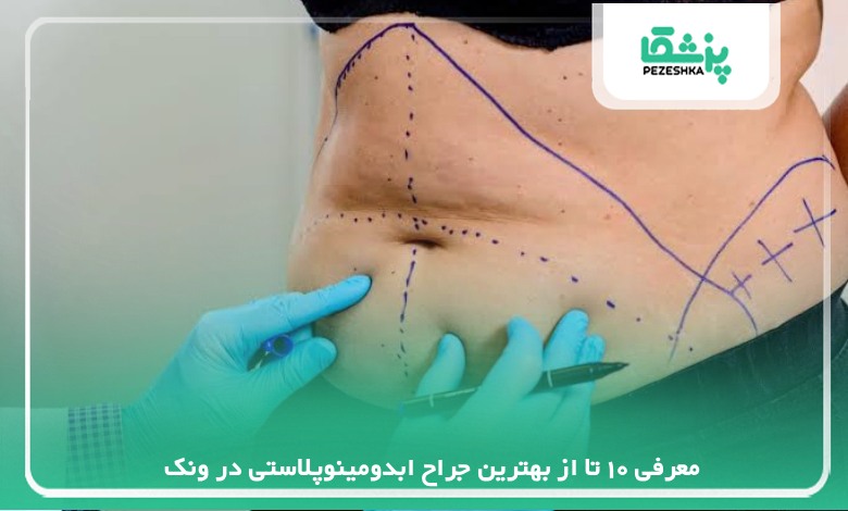 معرفی 10 تا از بهترین جراح ابدومینوپلاستی در ونک【سال1405】❤️