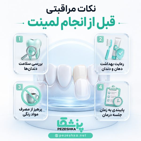 ویژگی بهترین دکتر لمینت در زعفرانیه