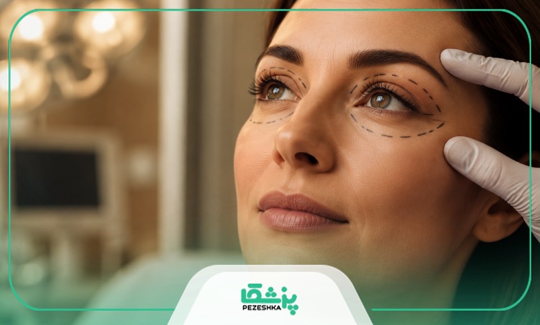 مراقبت های توصیه شده توسط بهترین جراح بلفاروپلاستی در یوسف آباد