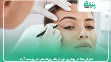 معرفی10تا از بهترین جراح بلفاروپلاستی در یوسف آباد【سال 1405 】❤️