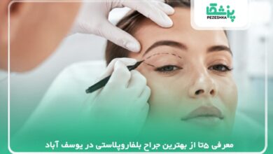 معرفی 5تا از بهترین جراح بلفاروپلاستی در یوسف آباد【سال 1405 】❤️