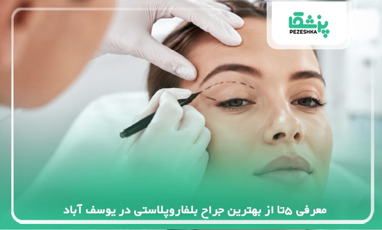 معرفی 5تا از بهترین جراح بلفاروپلاستی در یوسف آباد【سال 1405 】❤️