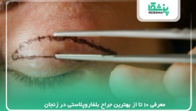 معرفی 10 تا بهترین جراح بلفاروپلاستی در زنجان【سال 1405】❤️