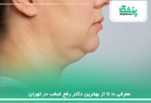 معرفی 10 تا از بهترین دکتر رفع غبغب در تهران