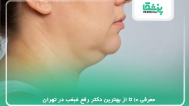 معرفی 10 تا از بهترین دکتر رفع غبغب در تهران