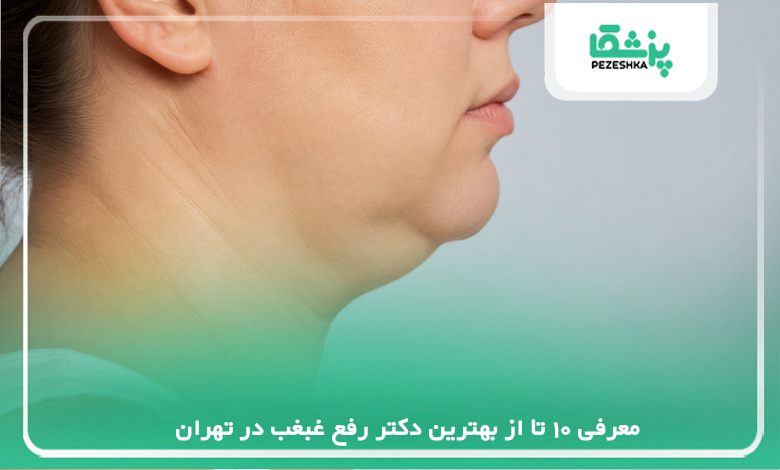 معرفی 10 تا از بهترین دکتر رفع غبغب در تهران