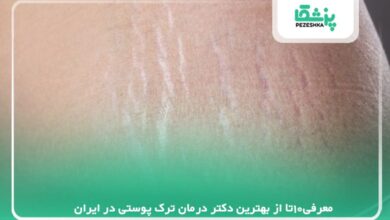 معرفی10تا از بهترین دکتر درمان ترک پوستی در ایران【سال1405】❤️