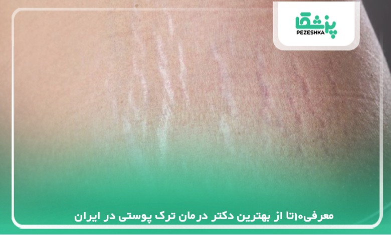 معرفی10تا از بهترین دکتر درمان ترک پوستی در ایران【سال1405】❤️