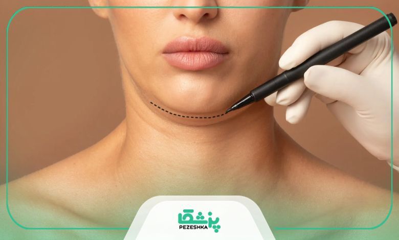روش های خانگی برای از بین بردن غبغب