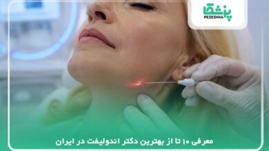 معرفی 10 تا از بهترین دکتر اندولیفت در ایران
