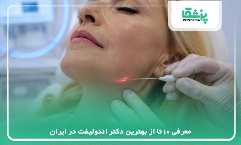 معرفی 10 تا از بهترین دکتر اندولیفت در ایران