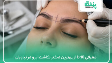 معرفی 10 تا از بهترین دکتر کاشت ابرو در نیاوران