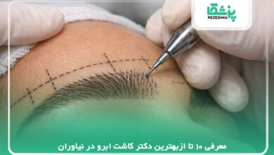 معرفی 10 تا ازبهترین دکتر کاشت ابرو در نیاوران【سال 1405】❤️