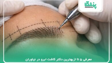 معرفی 5 تا ازبهترین دکتر کاشت ابرو در نیاوران【سال 1405】❤️