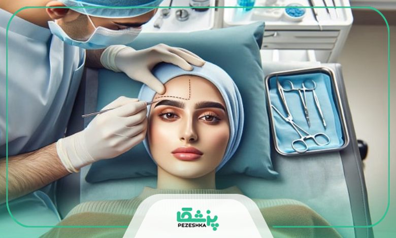 روش های مختلف کاشت ابرو